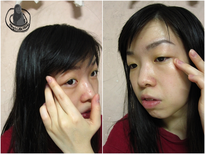 dr_morita_black_eye_3