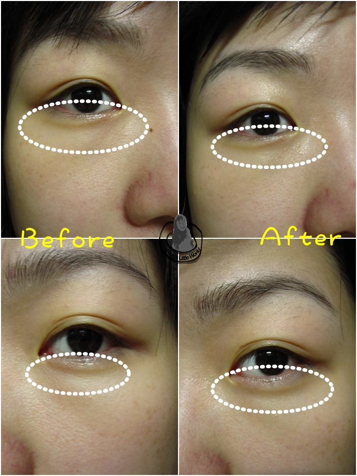 dr_morita_black_eye_5