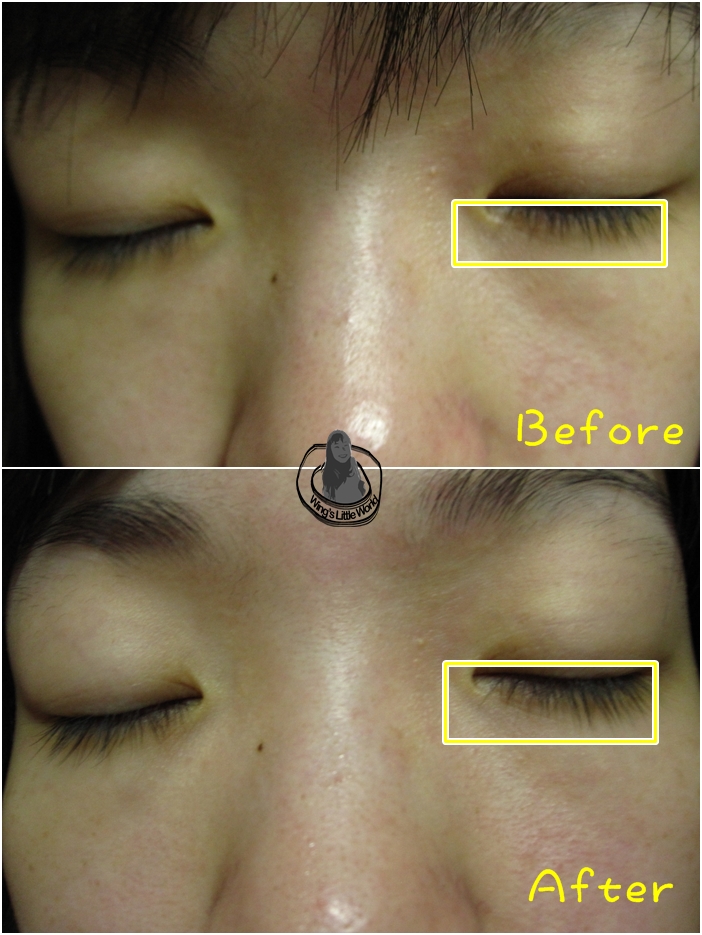 nestbeauty_centifolia_11