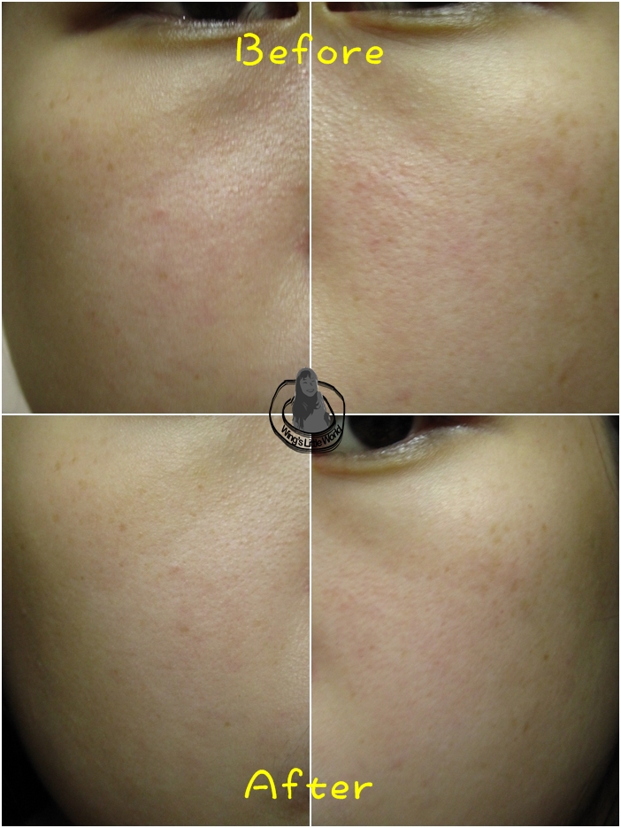 pretty_skin_aloe_mask_7