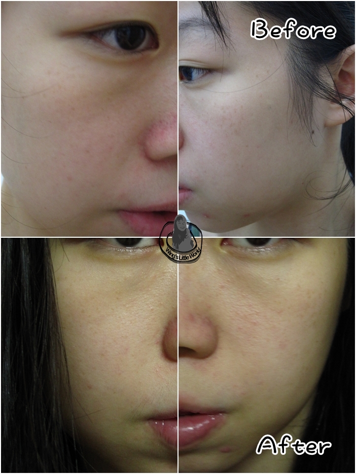 bevy-cleanser-mask-7