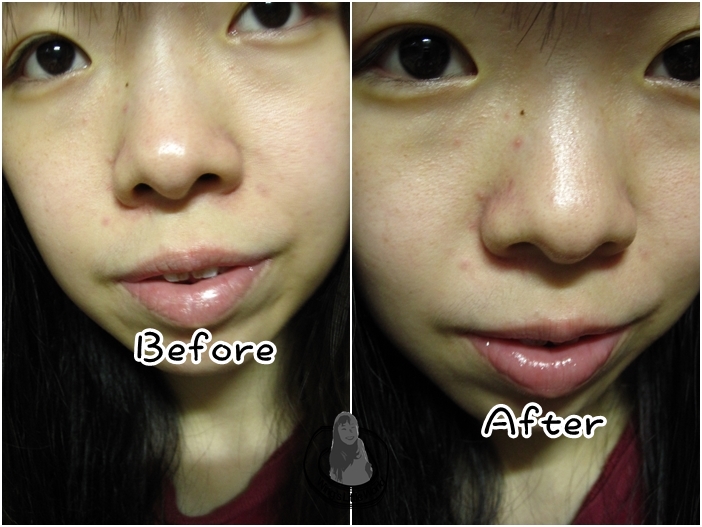 bevy-c-lumiwhite-moist-up-series-9