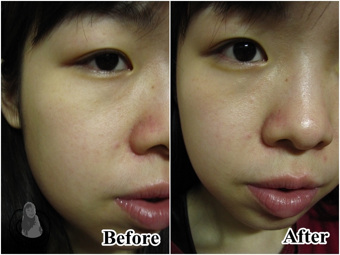 dr-morita-skincare-4