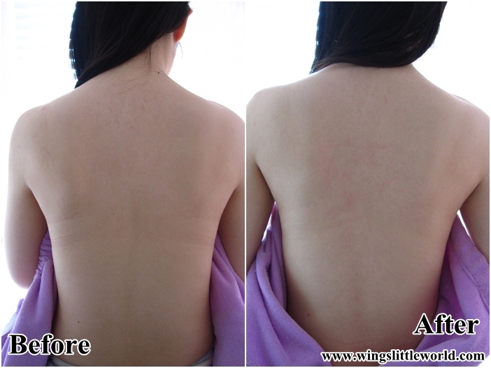 sense-of-pureskincare-back-10
