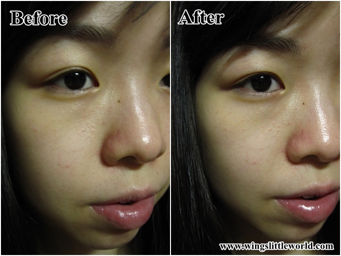 dcs-whitening-series-12