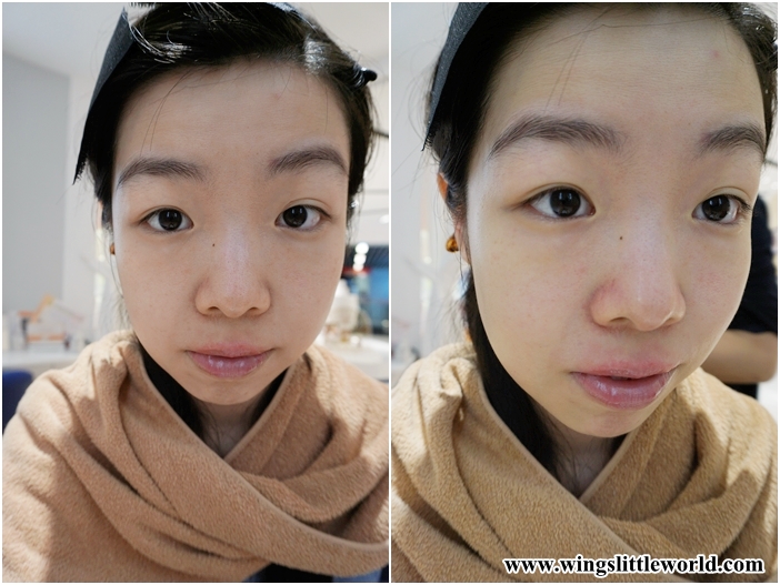 adjuvant-prinshell-6