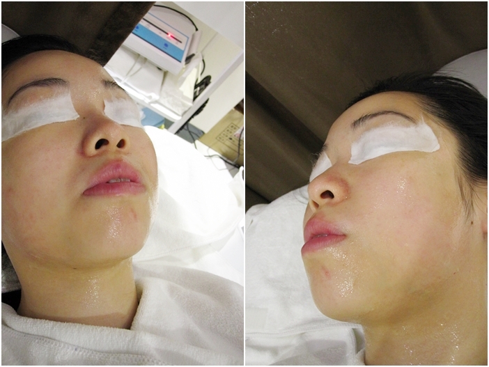 kc-korea-facial-14