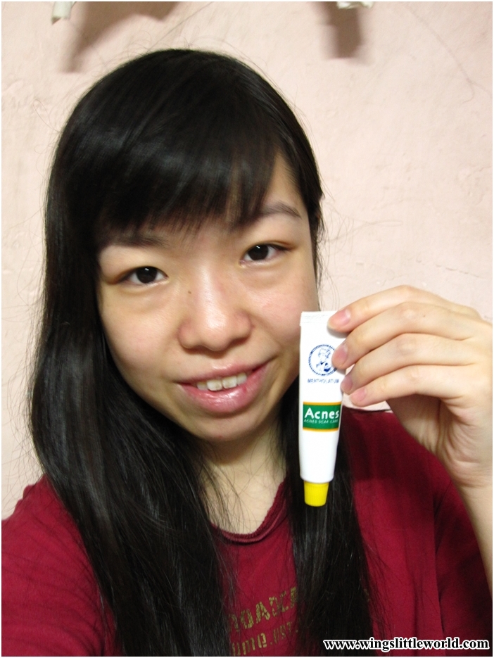 metholatum-acnes-scar-care-jell-7