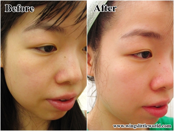 skin-need-skin-expert-skin-vitals-14