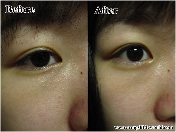 skin-need-skin-expert-skin-vitals-22