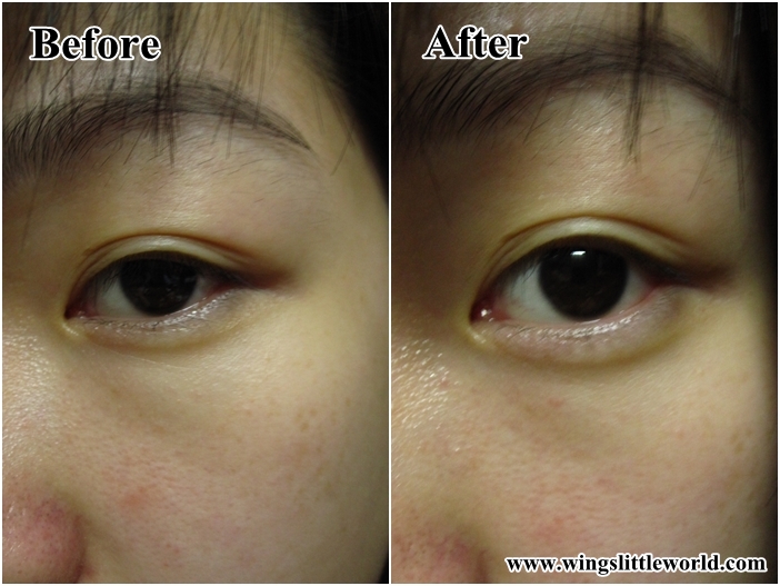 skin-need-skin-expert-skin-vitals-23