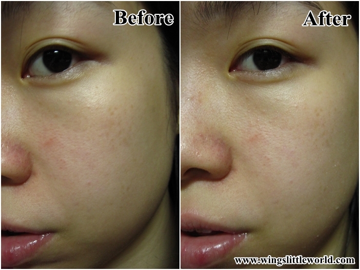 skin-need-skin-expert-skin-vitals-5