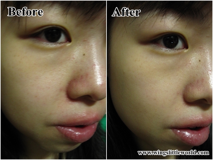 drthink-cleansing-device-15