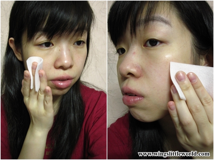 reskin-hydra-facial-ice-toner-7