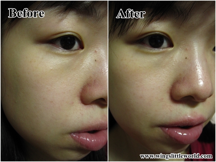 reskin-hydra-facial-ice-toner-8