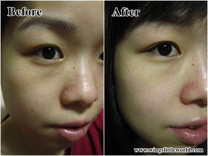 dr-jart-dermaclear-5