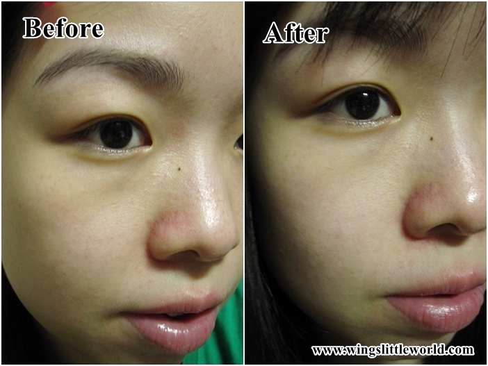 dr-jart-dermaclear-7