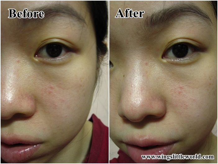 freshline-powder-skin-polisher-10