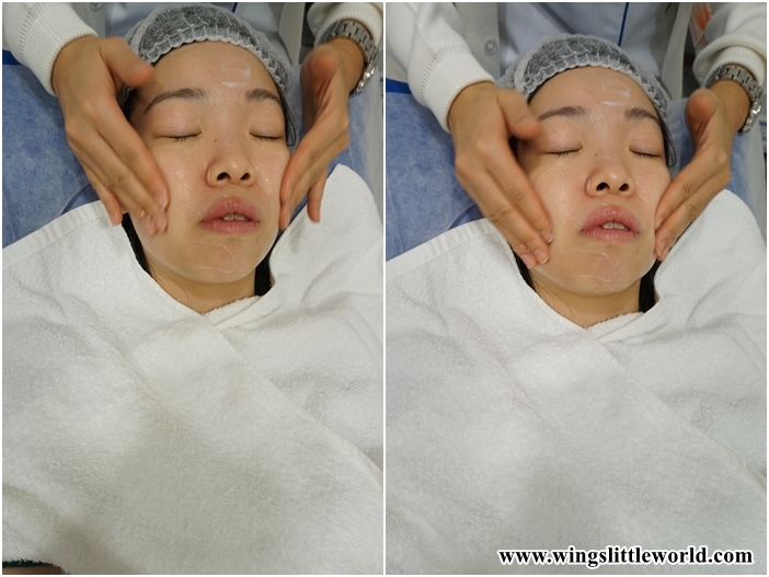 faceit-restylane-treatment-1