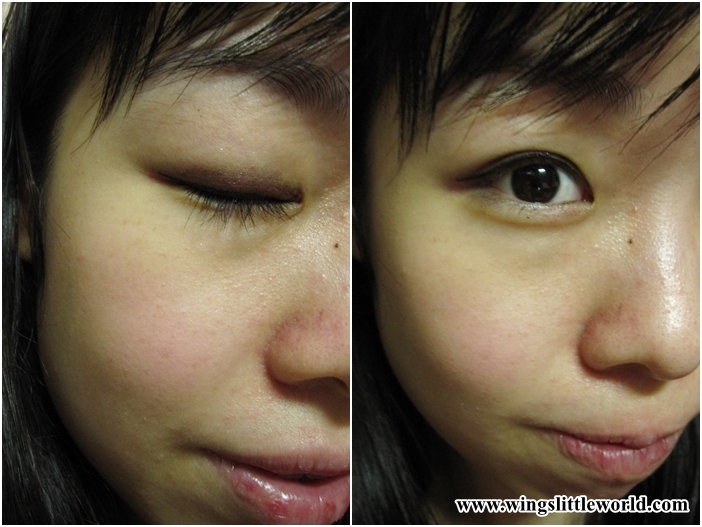 adjuvant-ae-clear-jel-6