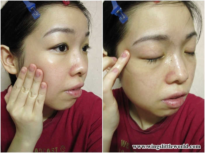 adjuvant-ae-clear-jel-7