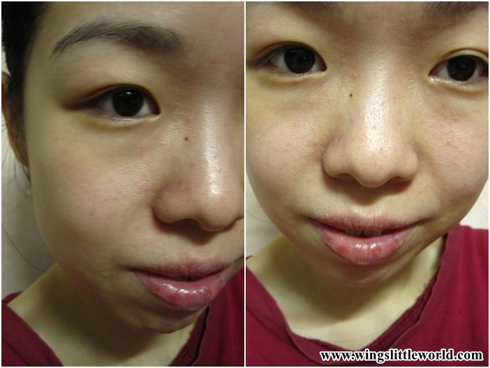 adjuvant-ae-clear-jel-8