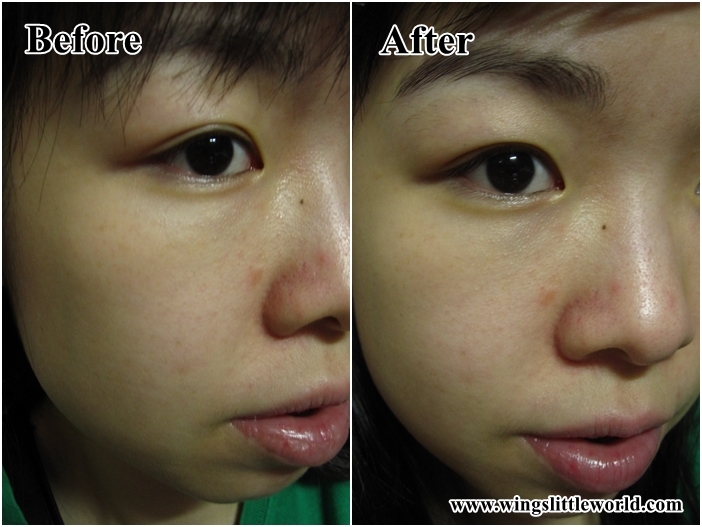 loreal-paris-revitalift-filler-12