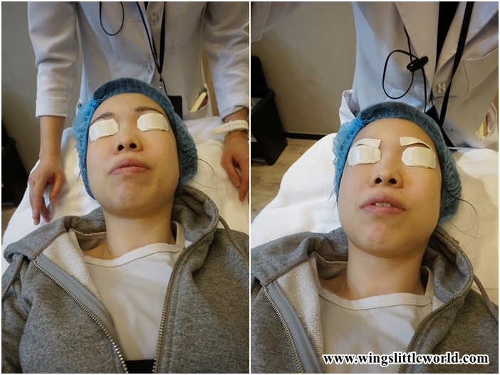 aesmedic-picolaser-10