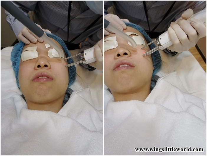 aesmedic-picolaser-11