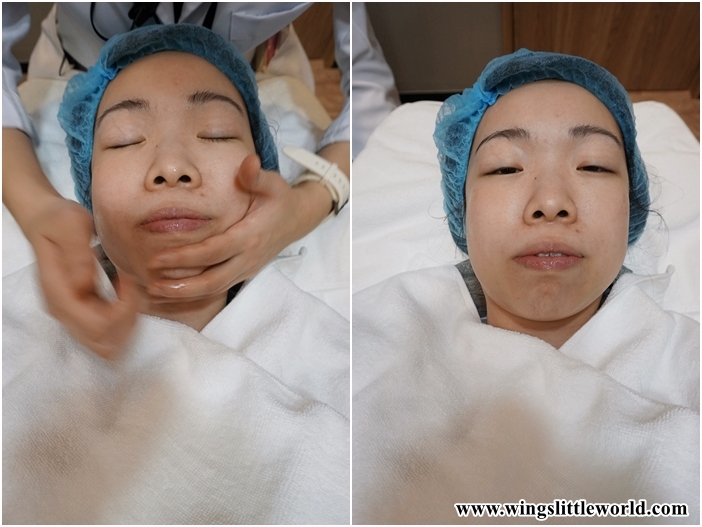 aesmedic-picolaser-13-edited