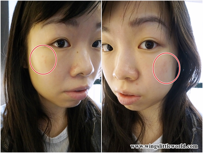 aesmedic-picolaser-14