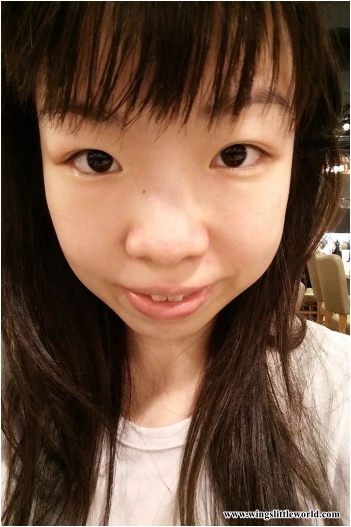 aesmedic-picolaser-16