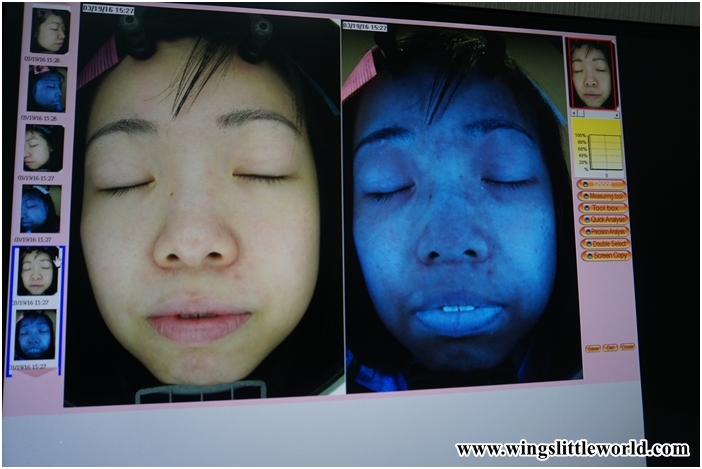 aesmedic-picolaser-5