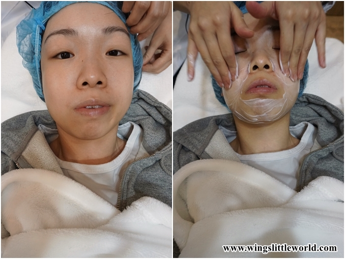 aesmedic-picolaser-7