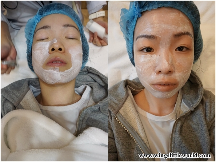 aesmedic-picolaser-8