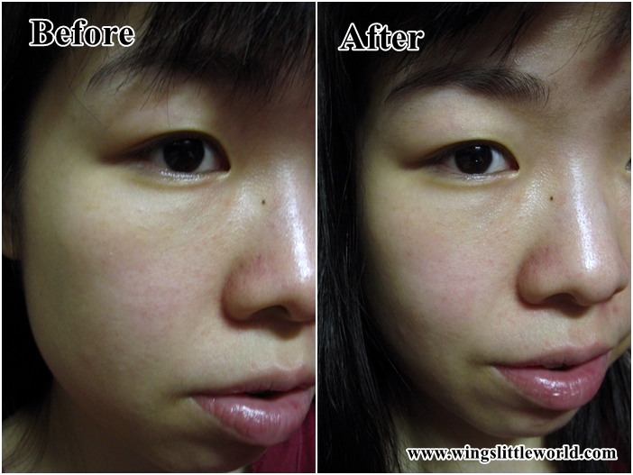 shiseido-microtargeting-spot-corrector-5