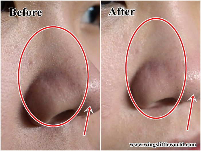 cnp-laboratory-black-head-clear-kit-7