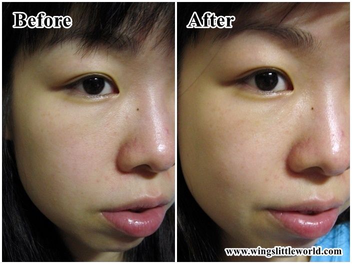 olay-white-radiance-7